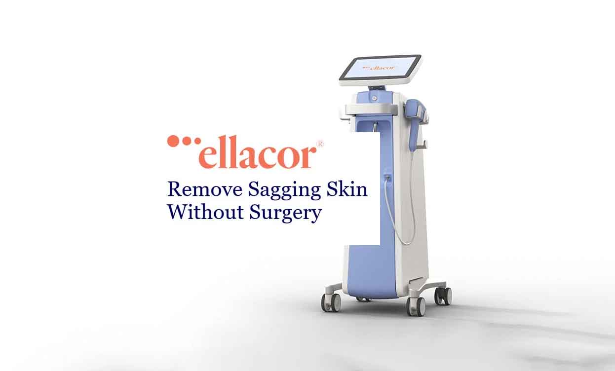 Introducing Ellacor: Non-Surgical Sagging Skin Treatment