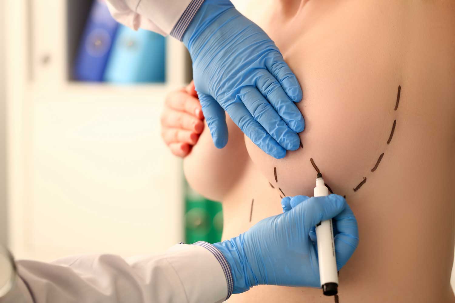 How to Choose the Right Plastic Surgeon for Breast Surgery?