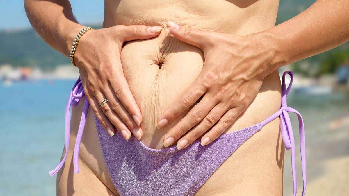 How to Choose the Right Plastic Surgeon for Tummy Tuck Treatment?