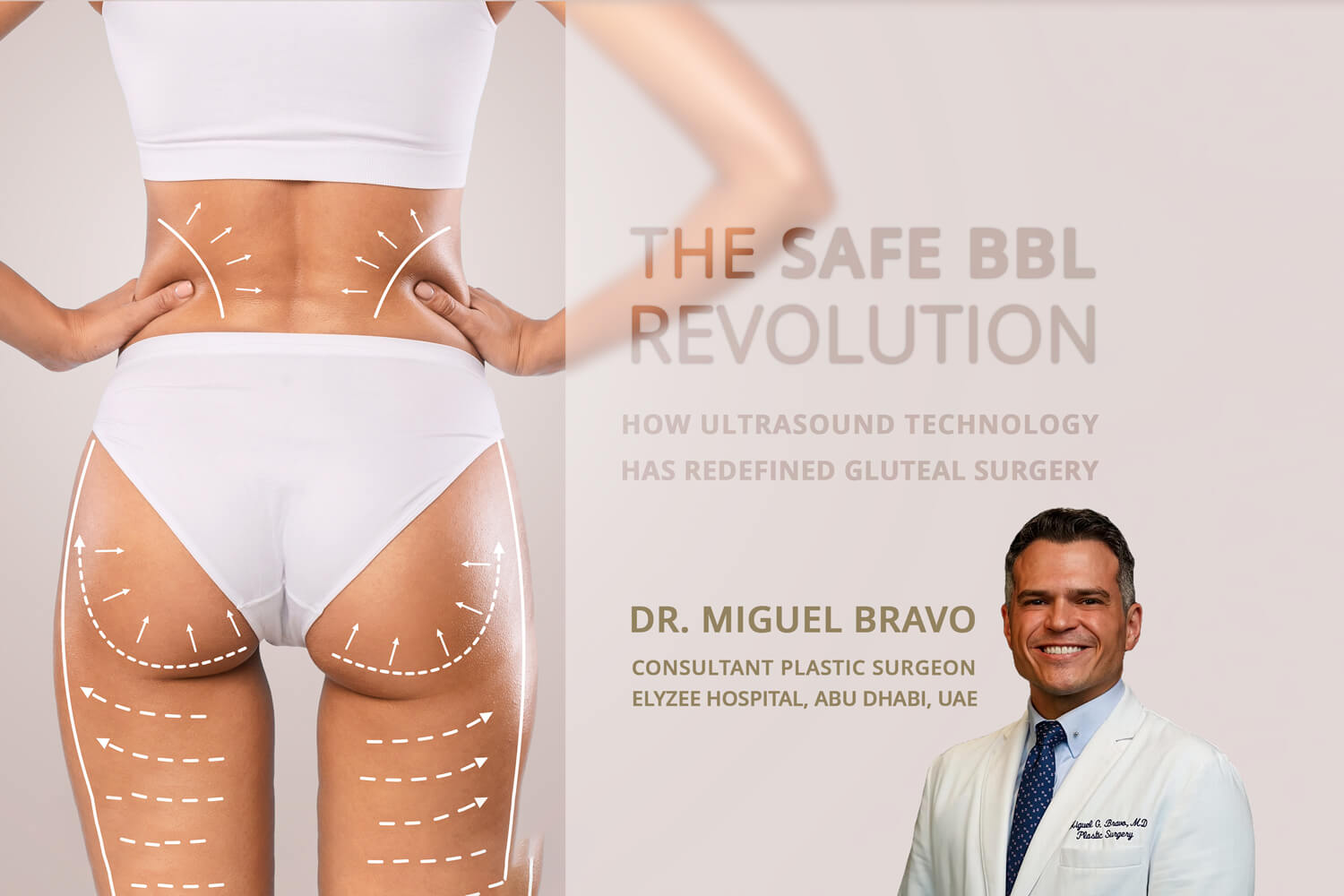 ثورة “BBL الآمن”: كيف أعادت تقنية الموجات فوق الصوتية تعريف جراحة تكبير الأرداف