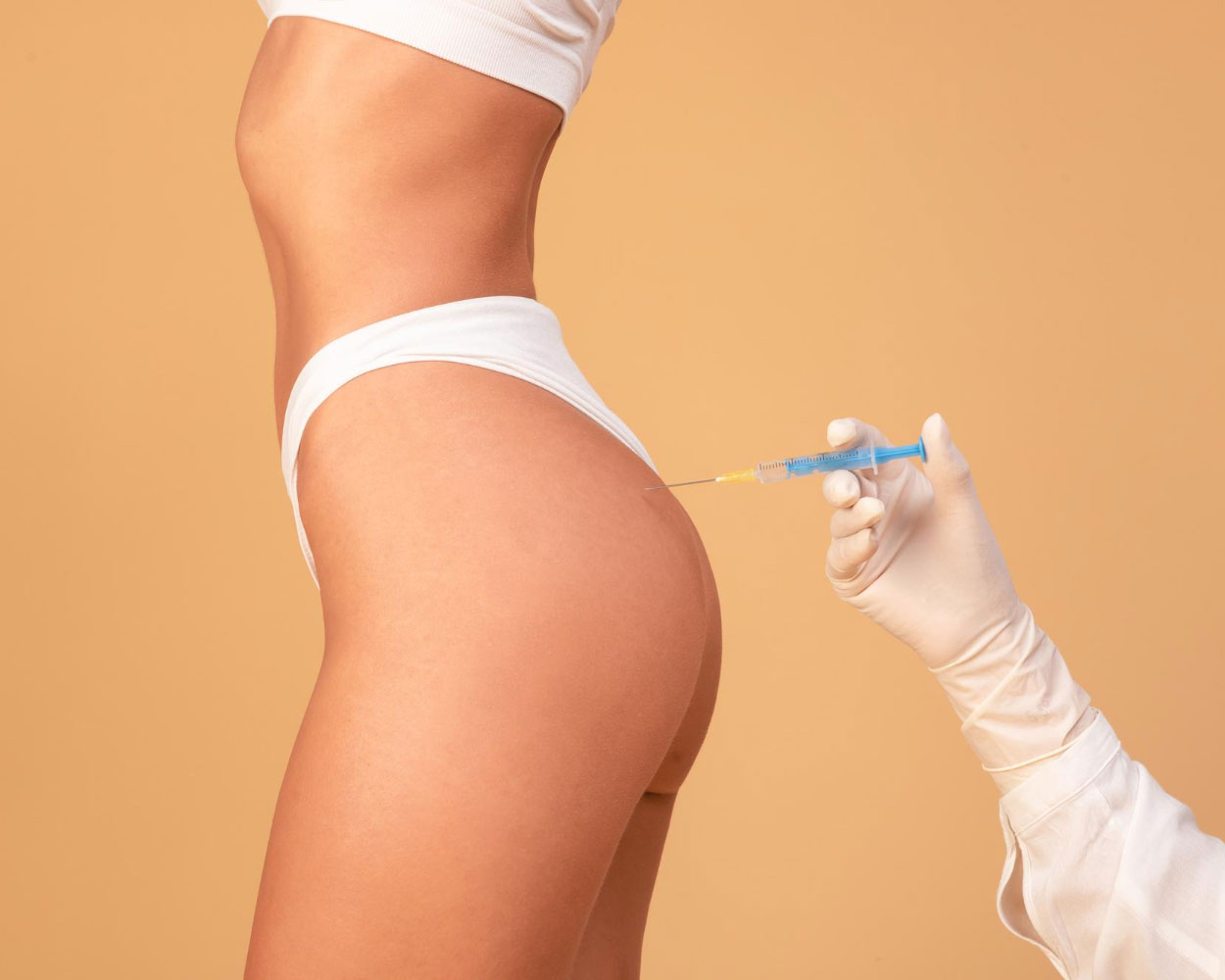 Butt Filler Procedure