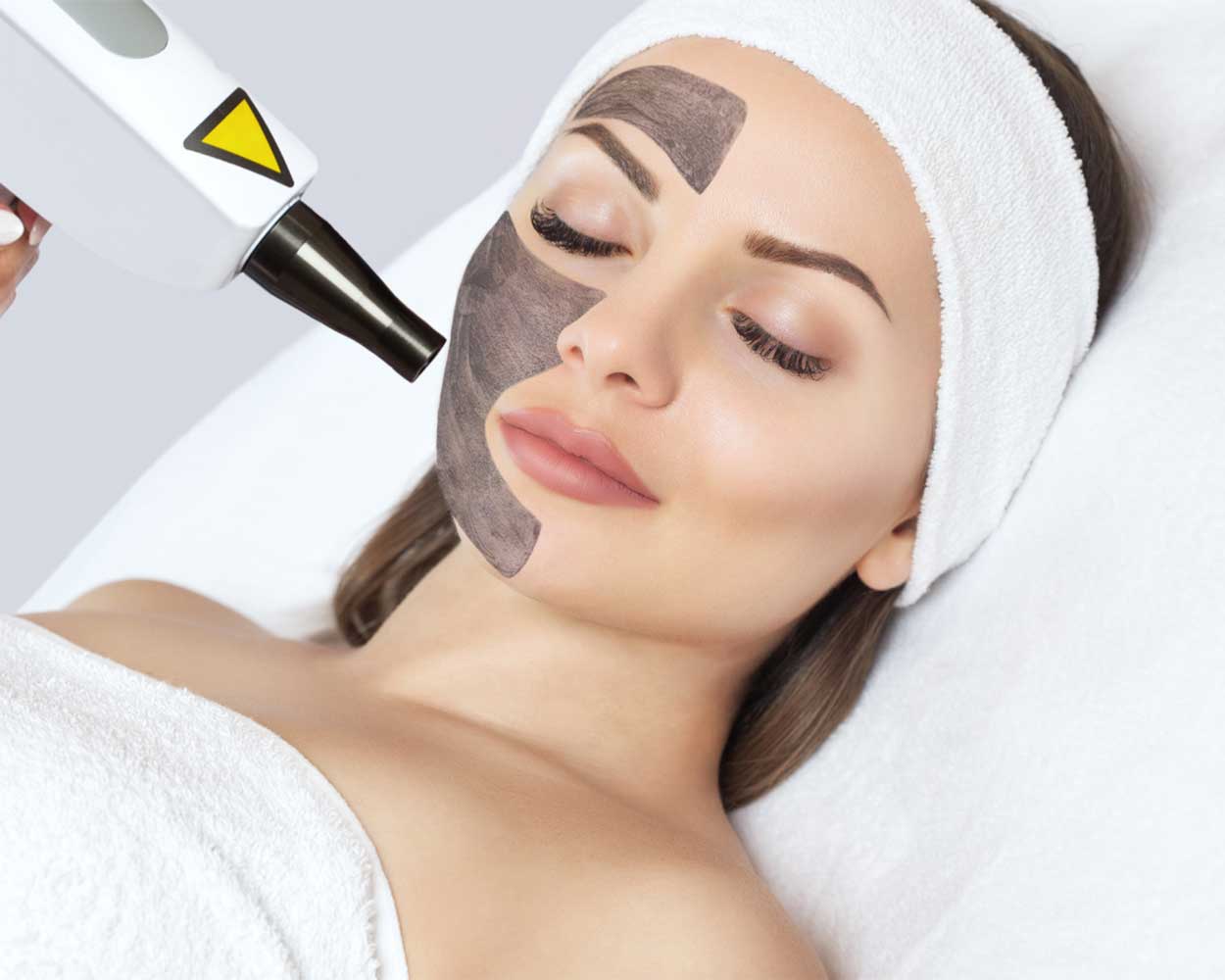 Carbon Peel Facial