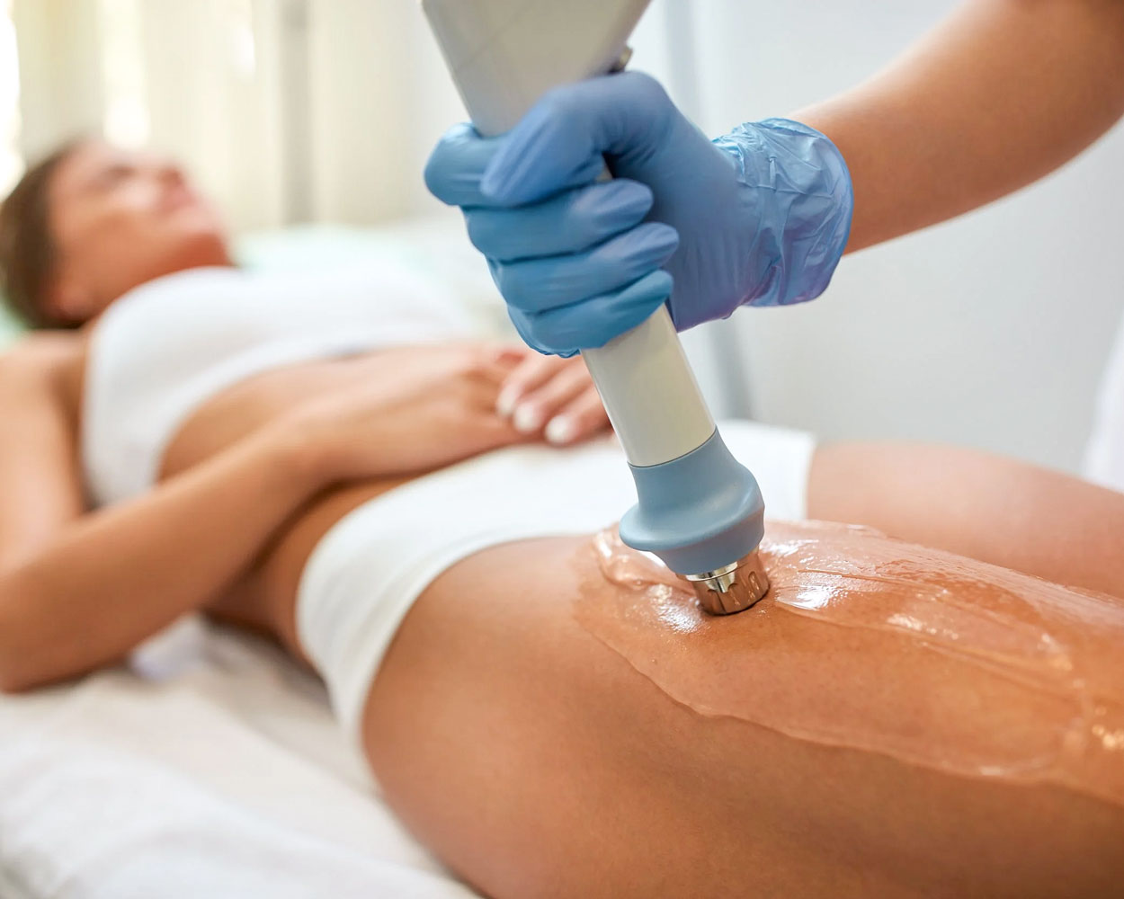 Cellulite Treatment