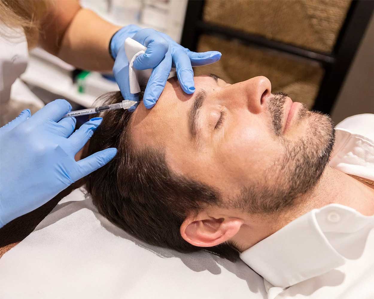 Hair Filler Procedure