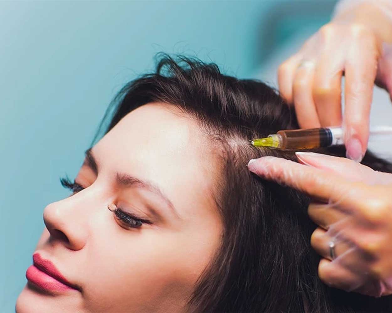 PRP Procedure for Hair