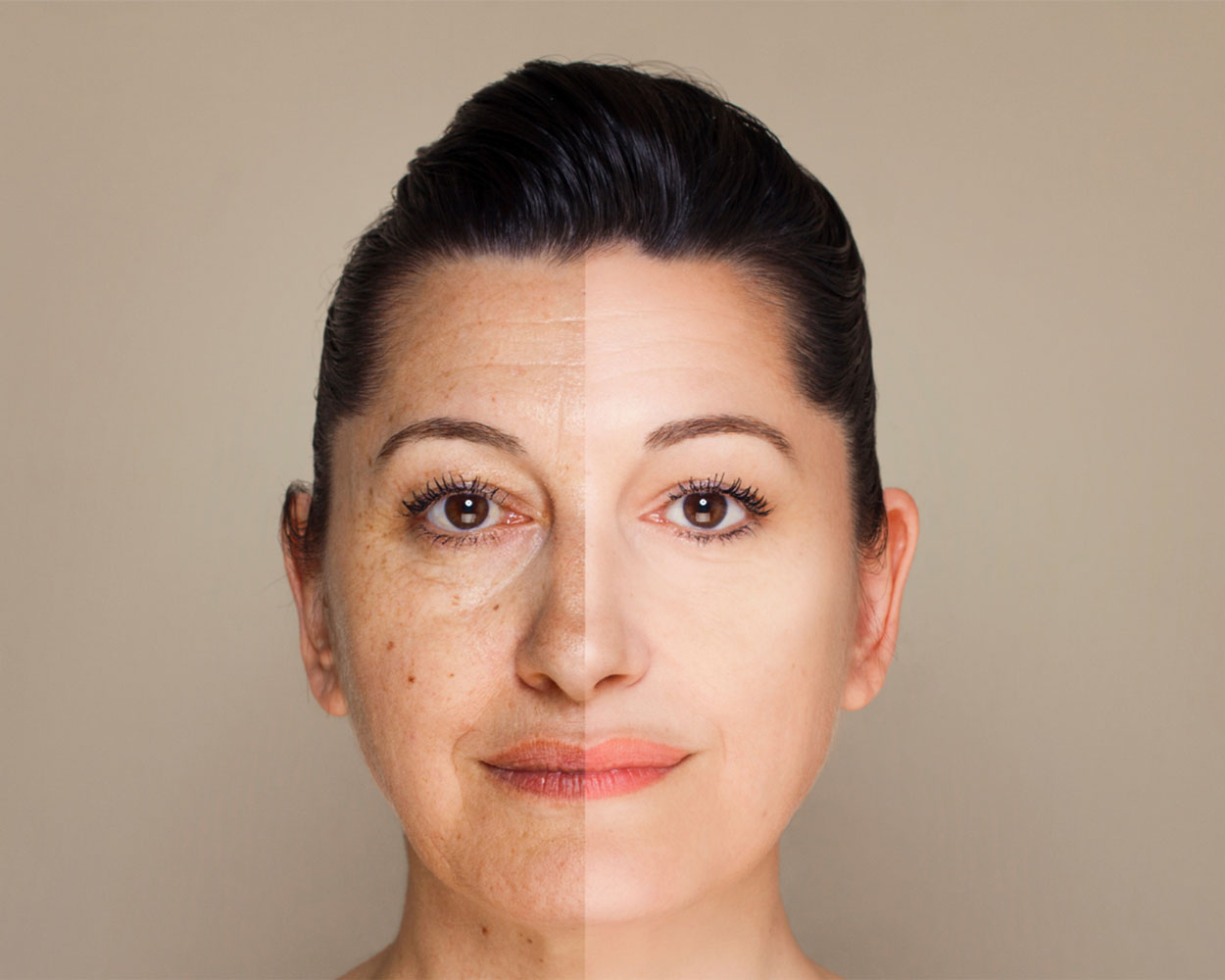 PRP Skin Rejuvenation