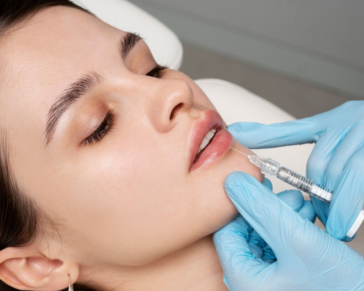 Russian Lips Procedure