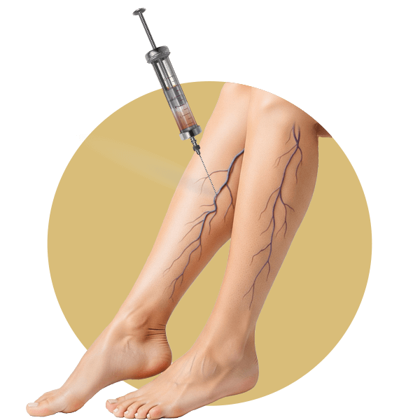 Elyzee Hospital - Vascular and Endovascular Surgery