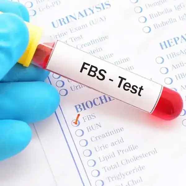 Fasting Blood Sugar Test