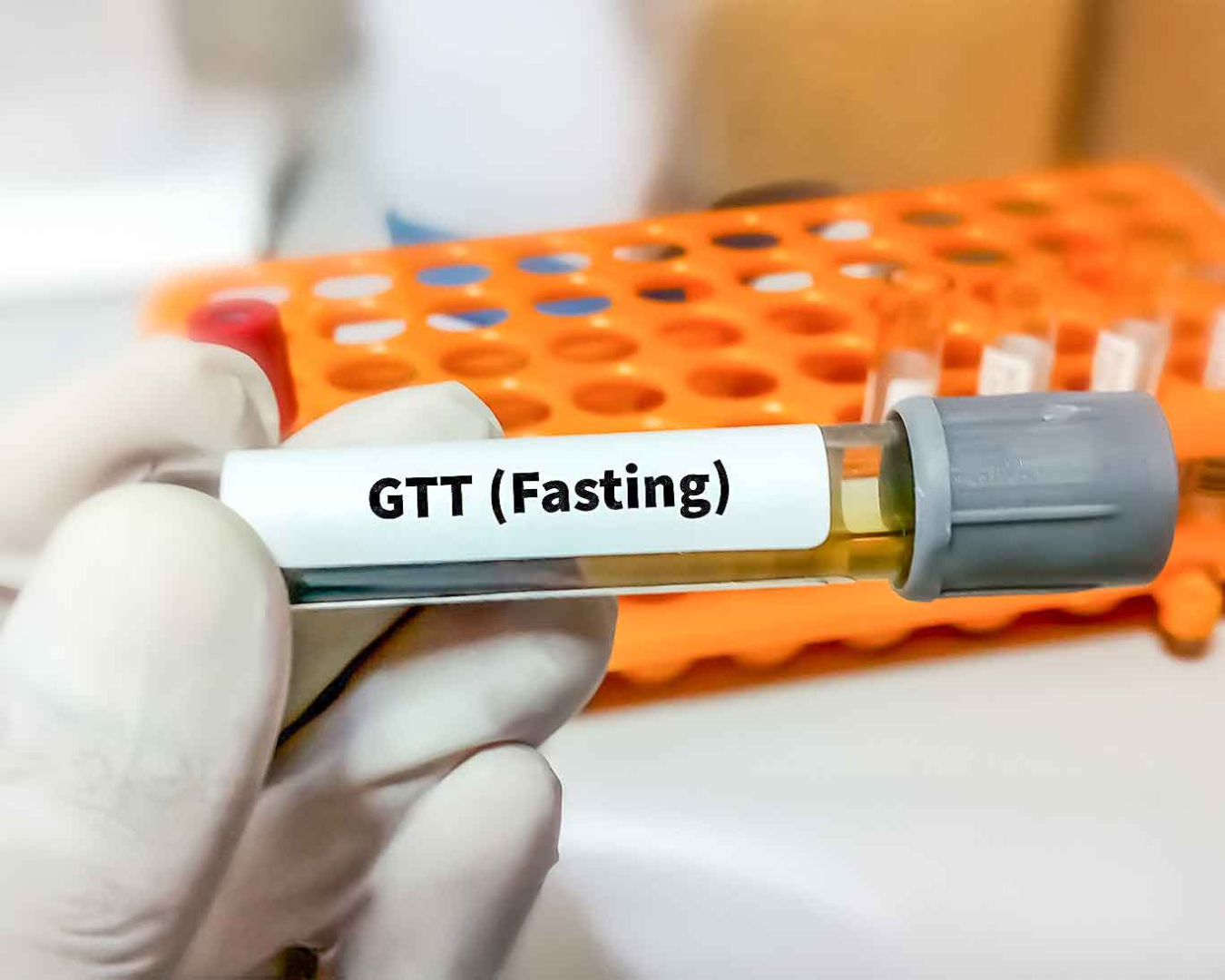 Glucose Tolerance Test (GTT)