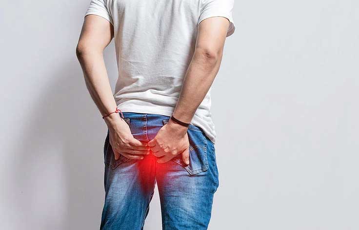 Hemorrhoids Treatment with HAL-RAR Procedure
