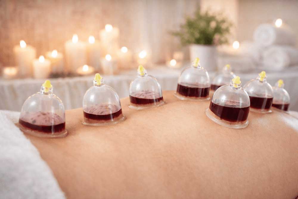 Wet Cupping (Hijama)