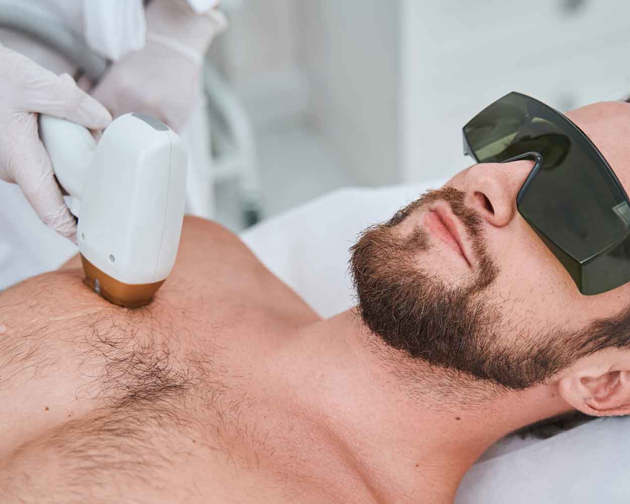 Laser Hair Removal for Men