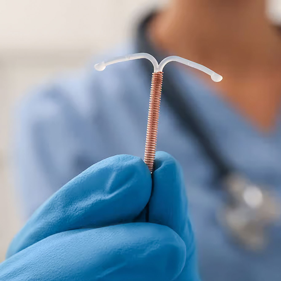 IUD Insertion & Removal