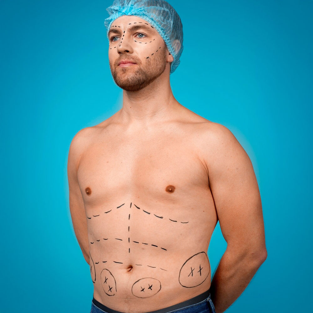Male Aesthetic & Reconstructive Procedures