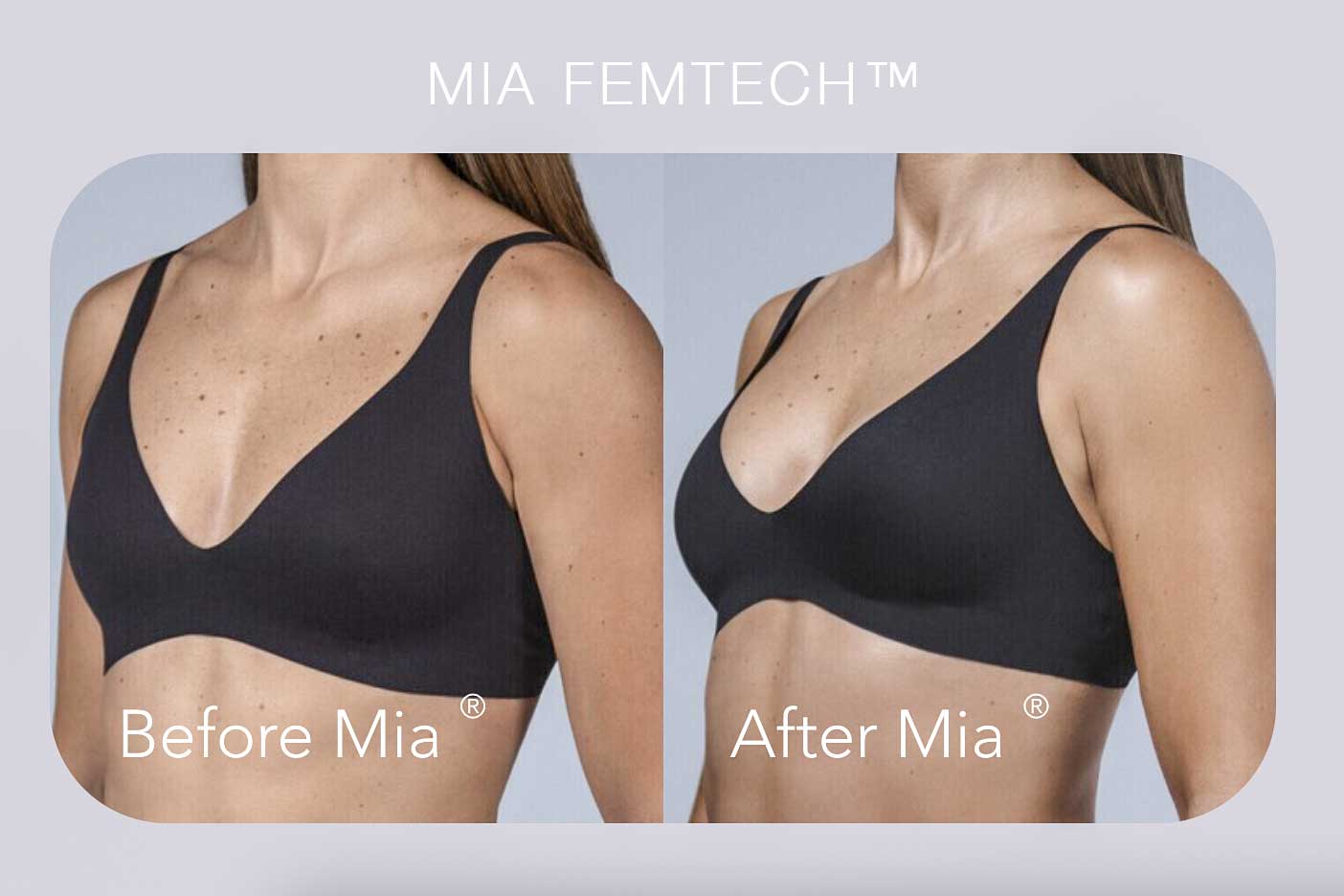 تقنية ميا (Mia Femtech™) – تعزيز وتناسق الثدي