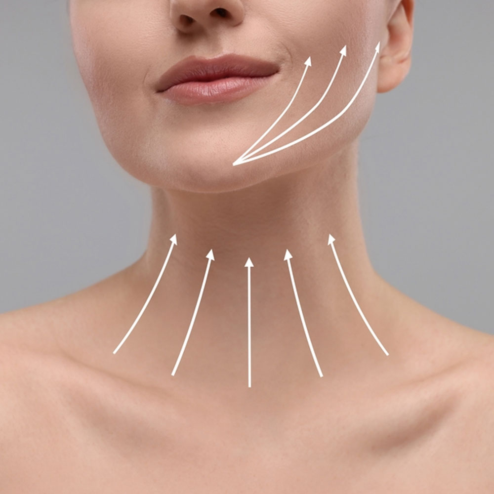 Neck Lift