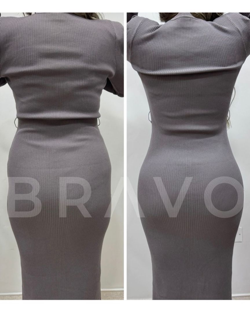 Dr. Miguel Bravo - Before & After Results 5