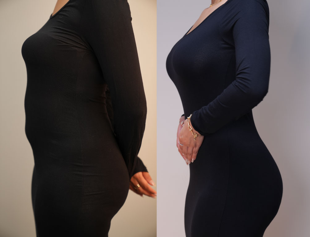 Dr. Mohammed Khamas - Before & After Results 3