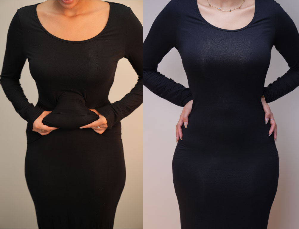 Dr. Mohammed Khamas - Before & After Results 4