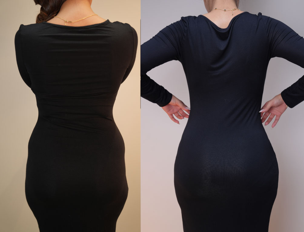 Dr. Mohammed Khamas - Before & After Results 5