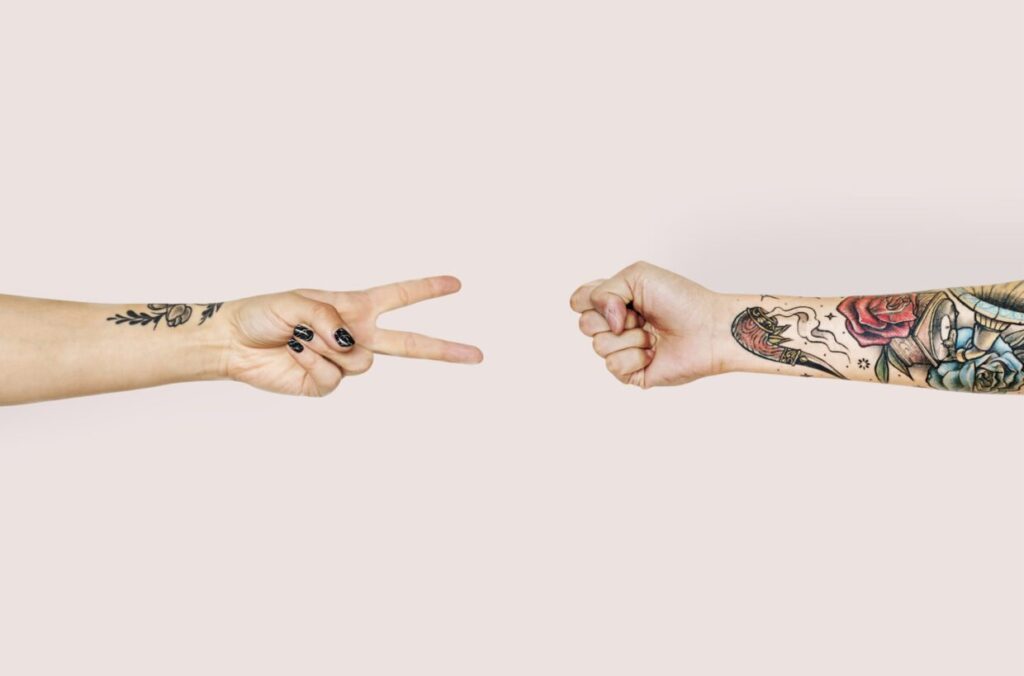 Tattoo Removal