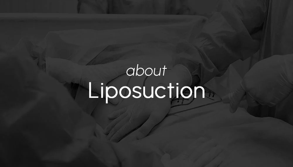 Everything You Need to Know about Liposuction
