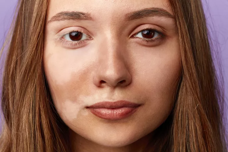 Pigmentation Procedure in Abu Dhabi